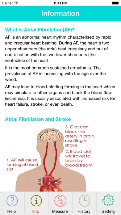 Photo AFib Detector Screenshots