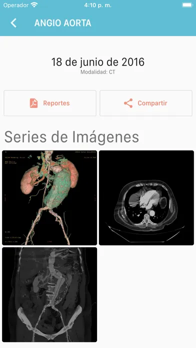 EMESALUD Ekran Görüntüleri