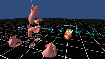 Скриншоты Living Heart for Cardboard VR