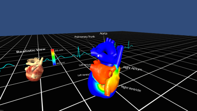 Скриншоты Living Heart for Cardboard VR