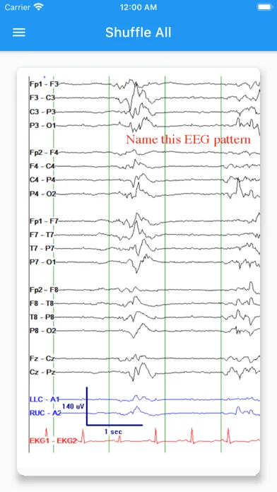 Capturas de pantalla de EEG Tutorial