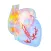 Atrial Fibrillation