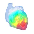 Epicardio Heart Simulator