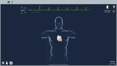 Screenshot di Epicardio Heart Simulator