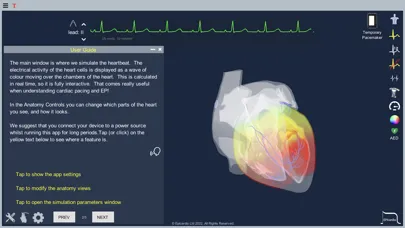 Screenshot di Epicardio Heart Simulator