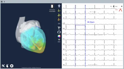 Screenshot di Epicardio Heart Simulator
