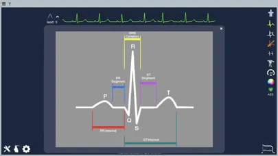 Screenshot di Epicardio Heart Simulator