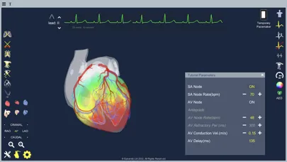 Screenshot di Epicardio Heart Simulator