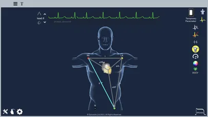 Screenshot di Epicardio Heart Simulator