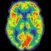 Radiology Core: Nuclear Medicine