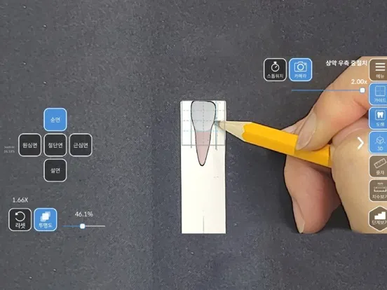 AR-D Morphology iPad  スクリーンショット