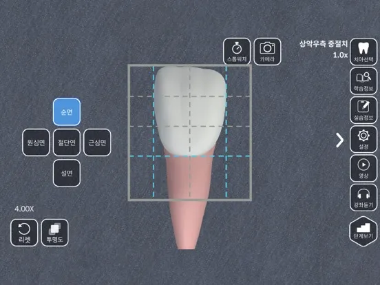 AR-D Morphology iPad  スクリーンショット