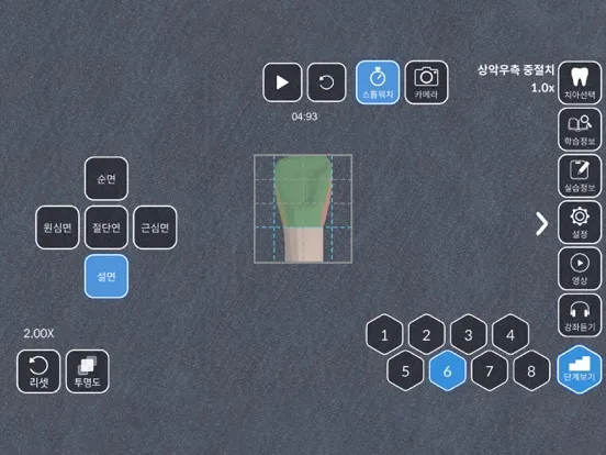 AR-D Morphology iPad  スクリーンショット