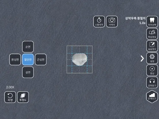 AR-D Morphology iPad  スクリーンショット