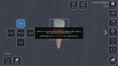 AR-D Morphology スクリーンショット