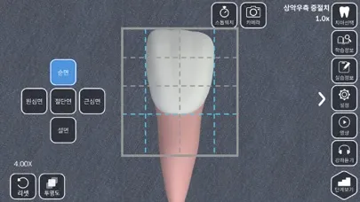 AR-D Morphology スクリーンショット