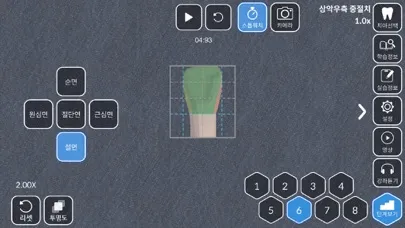 AR-D Morphology スクリーンショット