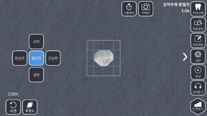 AR-D Morphology スクリーンショット