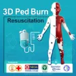 3D PED Burn Resuscitation 3D PED Burn Resuscitation