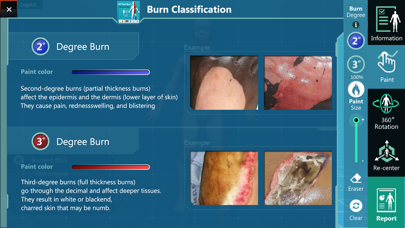Tangkapan layar 3D PED Burn Resuscitation