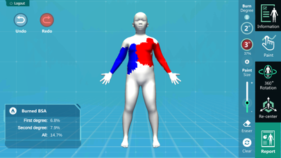 Tangkapan layar 3D PED Burn Resuscitation