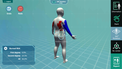 Tangkapan layar 3D PED Burn Resuscitation