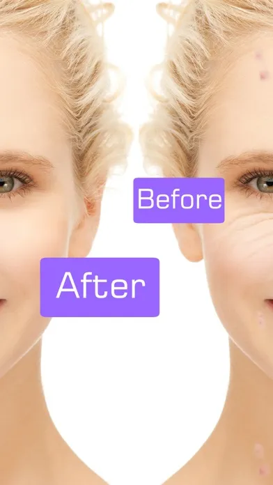 My visage camera - Remove your face acne , skin wrinkles eraser and blemish應用截圖
