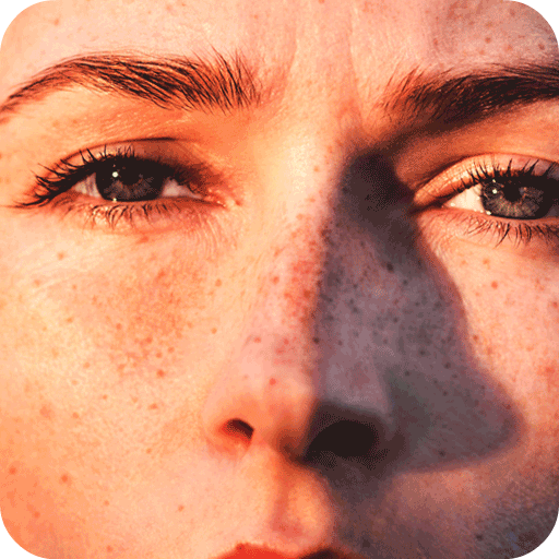 Get Rid Dark Spot On Skin Get Rid Dark Spot On Skin
