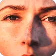 Get Rid Dark Spot On Skin