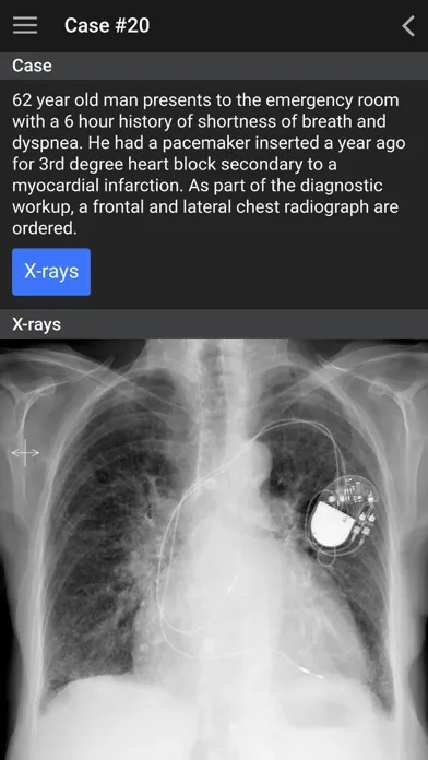 Zrzuty ekranu UBC Radiology