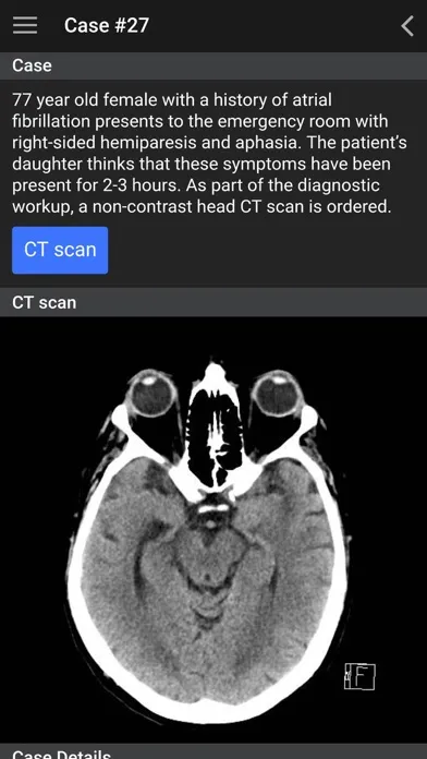 Zrzuty ekranu UBC Radiology