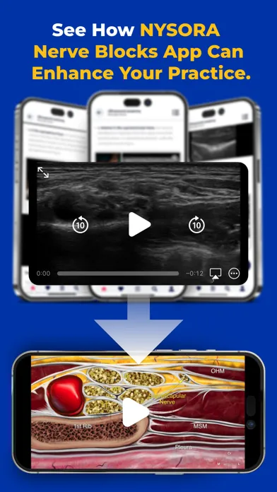 NYSORA Nerve Blocks Ekran Görüntüleri