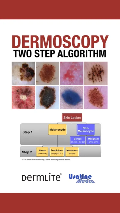 صور Dermoscopy Two Step Algorithm