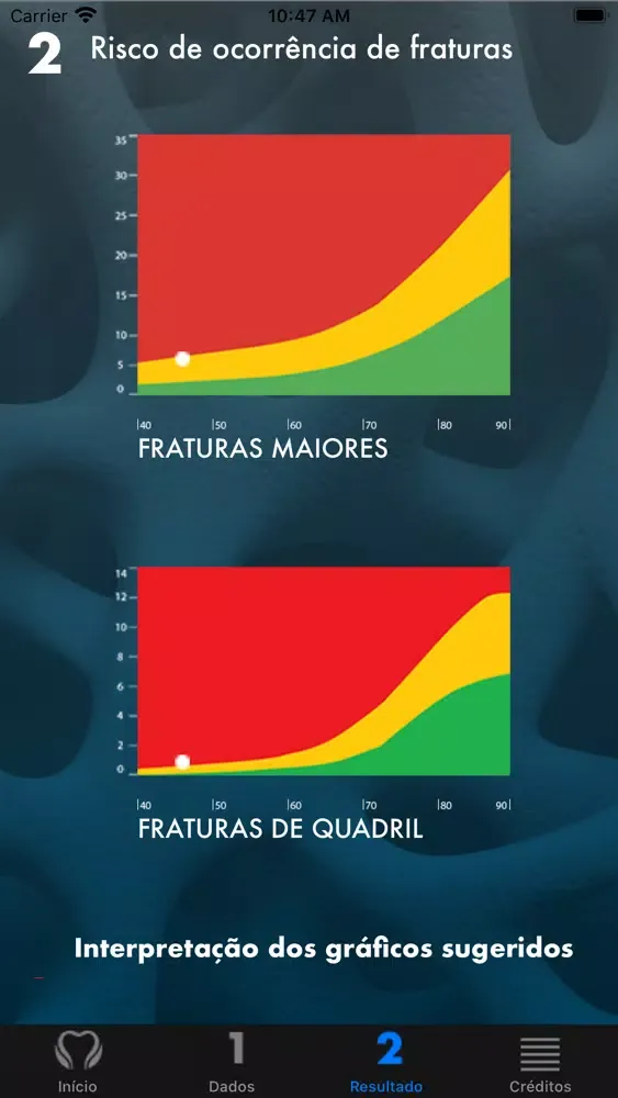 Captures d'écran de FRAX® ABRASSO