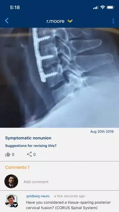 ACES – Cervical Fusion Forum Screenshots
