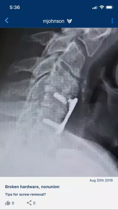 ACES – Cervical Fusion Forum Screenshots
