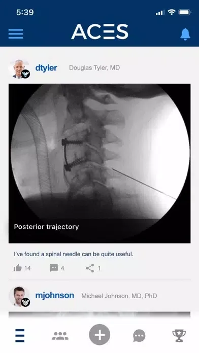 ACES – Cervical Fusion Forum Screenshots