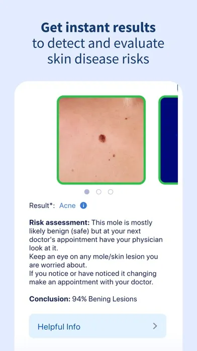 AI Dermatologist: Skin Scanner Ekran Görüntüleri
