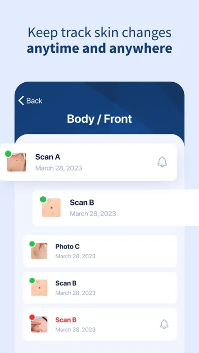 AI Dermatologist: Skin Scanner Ekran Görüntüleri
