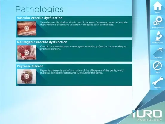 Captures d'écran de iURO Andrology PRO iPad 