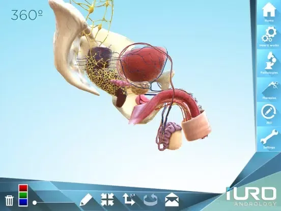 Captures d'écran de iURO Andrology PRO iPad 
