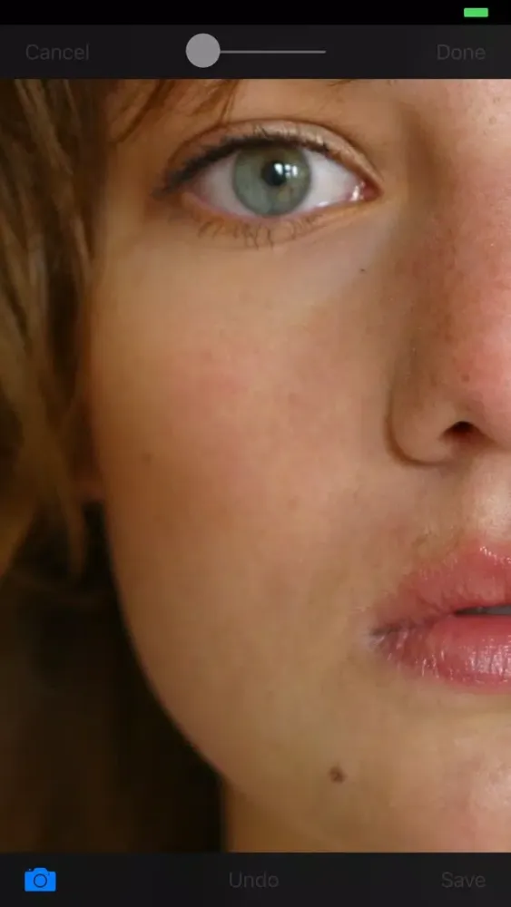 Blemish Remover HD स्क्रीनशॉट
