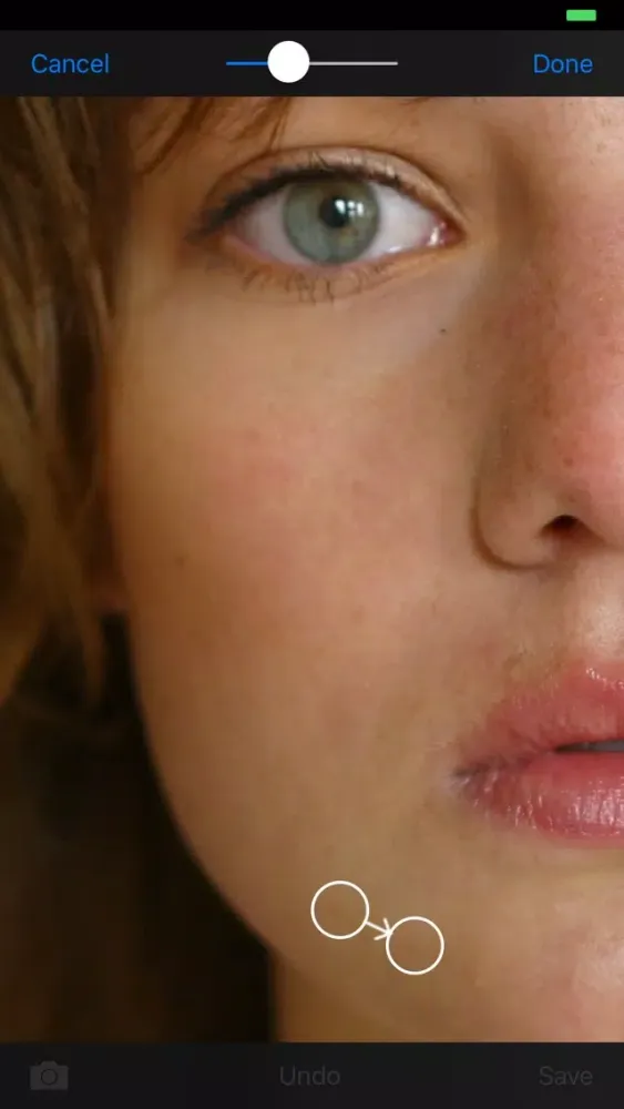 Blemish Remover HD स्क्रीनशॉट