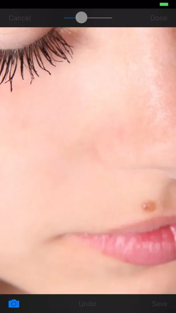 Blemish Remover HD स्क्रीनशॉट