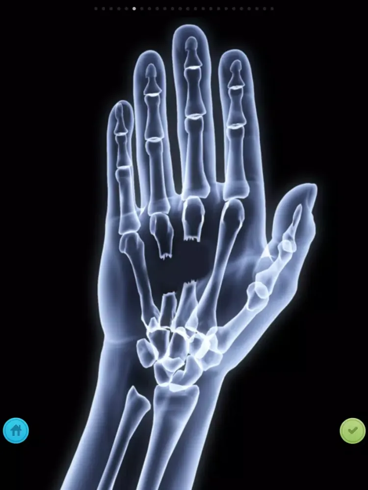 The X-Ray Scanner iPad  Ekran Görüntüleri