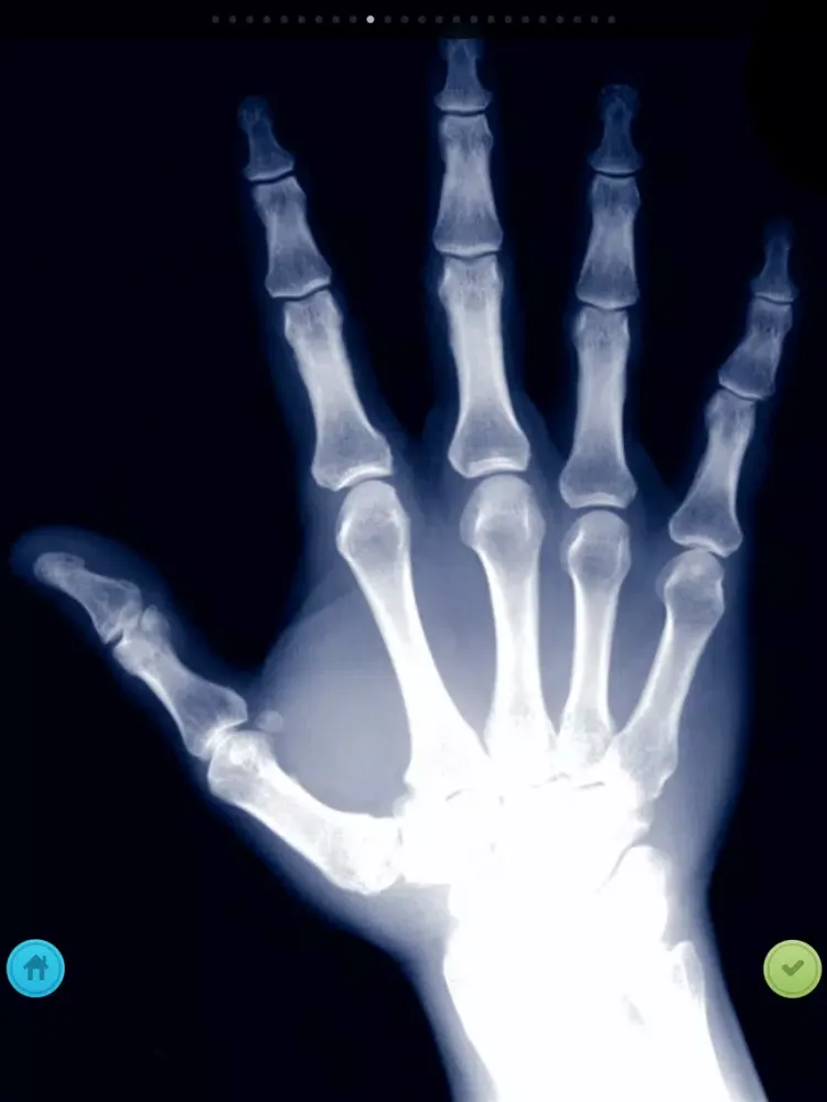 The X-Ray Scanner iPad  Ekran Görüntüleri