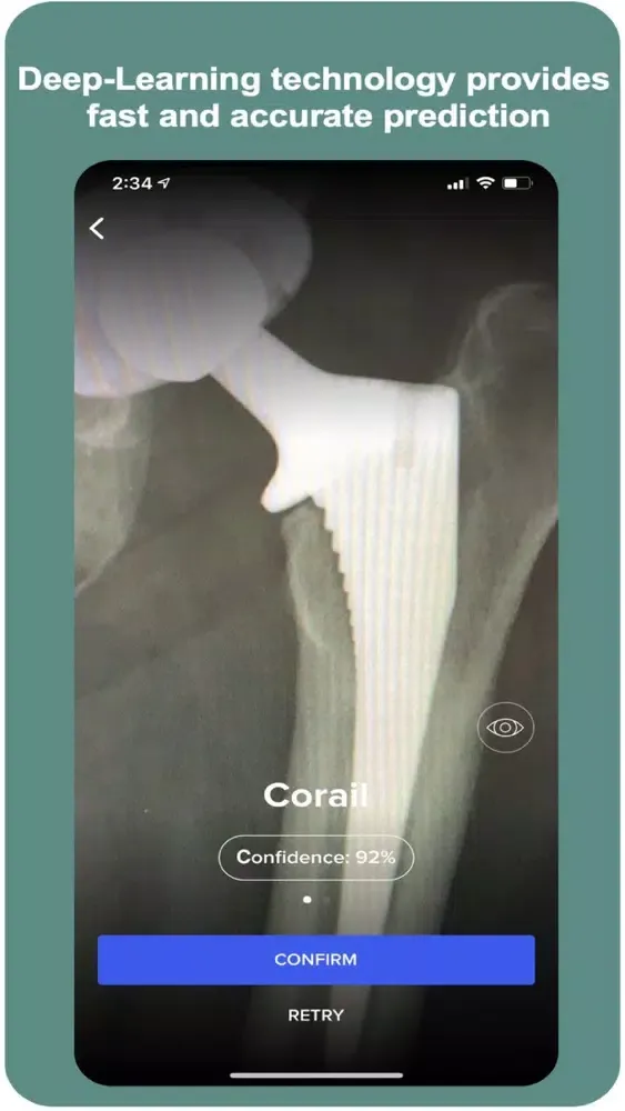 AIdentyfy Surgical Planning Screenshots