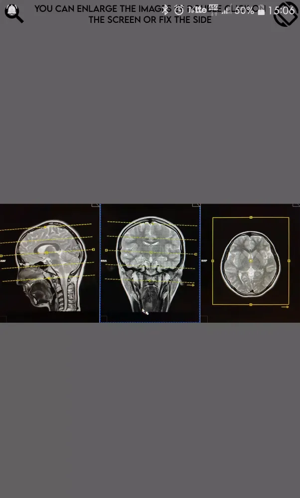 Magnetic Resonance Screenshots