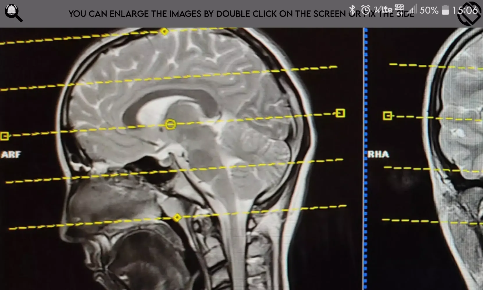 Magnetic Resonance Screenshots