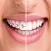 Design My Smile